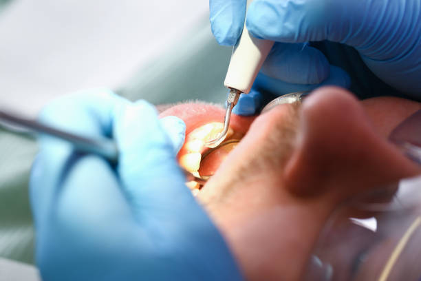 Best Pediatric Emergency Dentist in North Redington Beach, FL