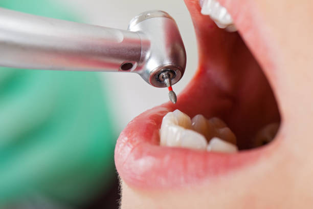 Best Urgent Dental Care for Toothache in North Redington Beach, FL
